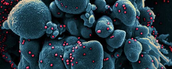 Коронавирус под микроскопом - 俄罗斯卫星通讯社