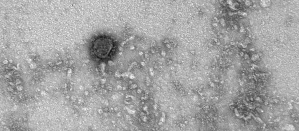Фотоснимок коронавируса - 俄罗斯卫星通讯社