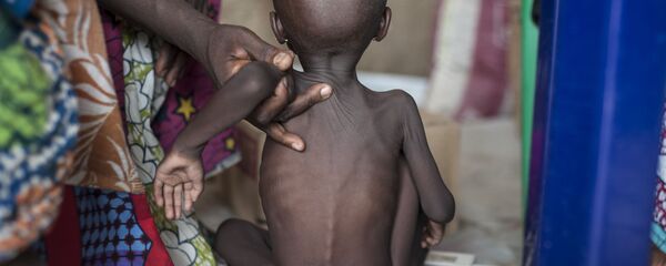 聯合國：若不採取必要措施 非洲超過1500萬兒童將挨餓 - 俄羅斯衛星通訊社