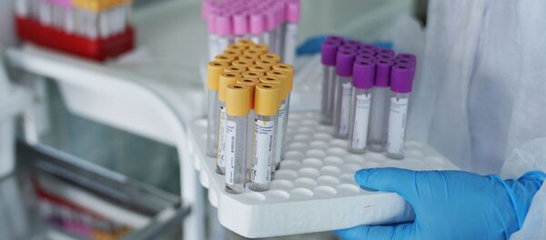 俄国家技术集团与俄直投基金将利用血浆生产治疗COVID-19感染的药物 俄国家技术集团与俄直投基金将利用血浆生产治疗COVID-19感染的药物 - 俄罗斯卫星通讯社