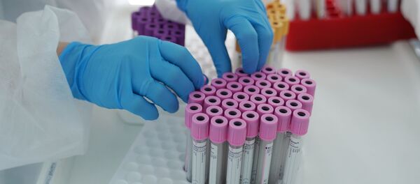 Медицинская сестра держит пробирки доноров плазмы крови с антителами на коронавирус CoVID-19 - 俄羅斯衛星通訊社