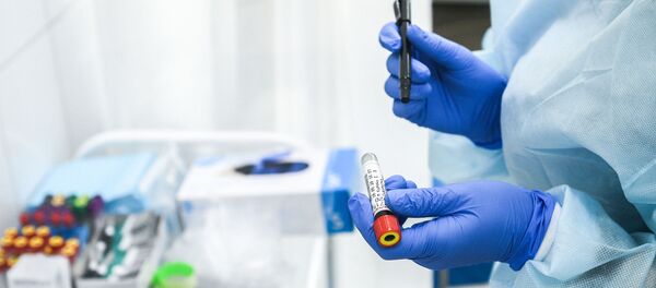 Пробирка с кровью сдавшего тест на наличие антител к вирусу SARS-CoV-2 - 俄罗斯卫星通讯社