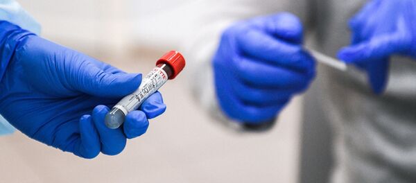 Пробирка с кровью сдавшего тест на наличие антител к вирусу SARS-CoV-2 - 俄罗斯卫星通讯社