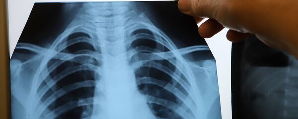 Врач с рентгеном легких в инфекционном корпусе, где лечат пациентов с COVID-19 Врач с рентгеном легких в инфекционном корпусе, где лечат пациентов с COVID-19 - 俄羅斯衛星通訊社