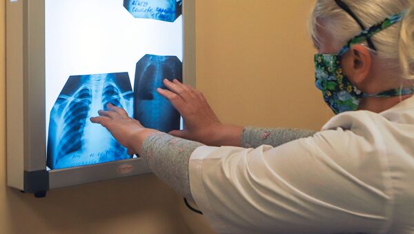  Врач с рентгеном легких в инфекционном корпусе, где лечат пациентов с COVID-19 - 俄罗斯卫星通讯社