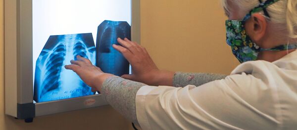 Врач с рентгеном легких в инфекционном корпусе, где лечат пациентов с COVID-19 Врач с рентгеном легких в инфекционном корпусе, где лечат пациентов с COVID-19 - 俄罗斯卫星通讯社