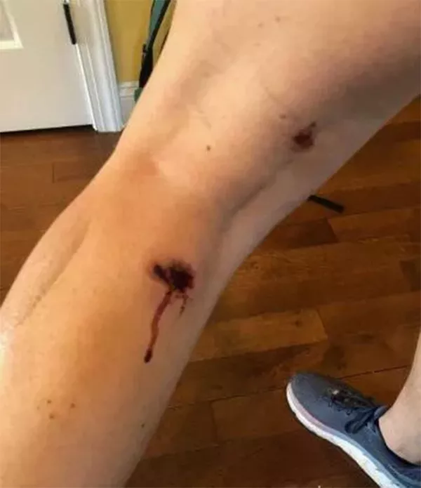 美國警察數次向俄羅斯衛星通訊社記者射擊 美國警察數次向俄羅斯衛星通訊社記者射擊 - 俄羅斯衛星通訊社